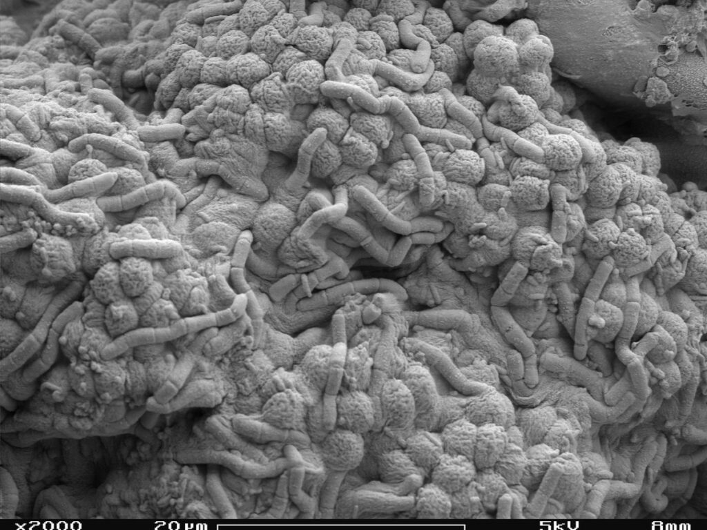 Algae and bacteria in Scanning Electron Microscope, magnification 2000x
