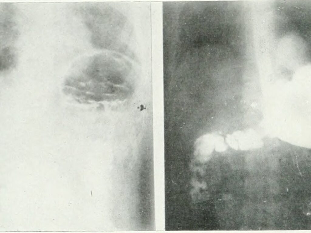 Archives of physical medicine and rehabilitation (1920) (14570508199)