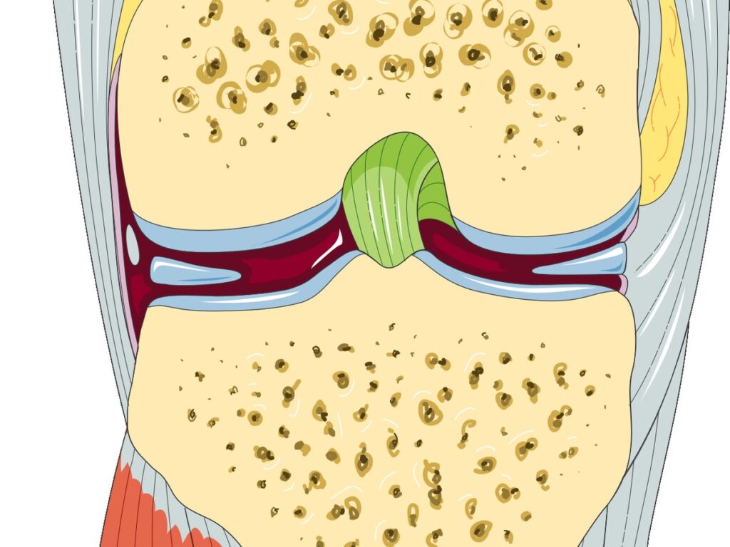 Knee - Frontal view 1 -- Smart-Servier